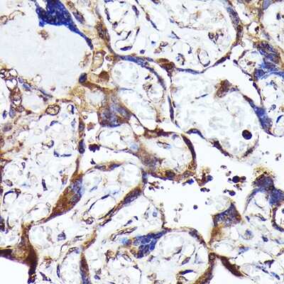 Immunohistochemistry-Paraffin: MTMR4 Antibody - BSA Free [NBP3-05113]
